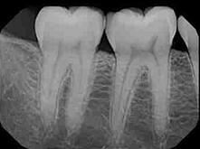 gabinet dentystyczny Dermadent Sanok - endodoncja, periodontologia, rtg zębów