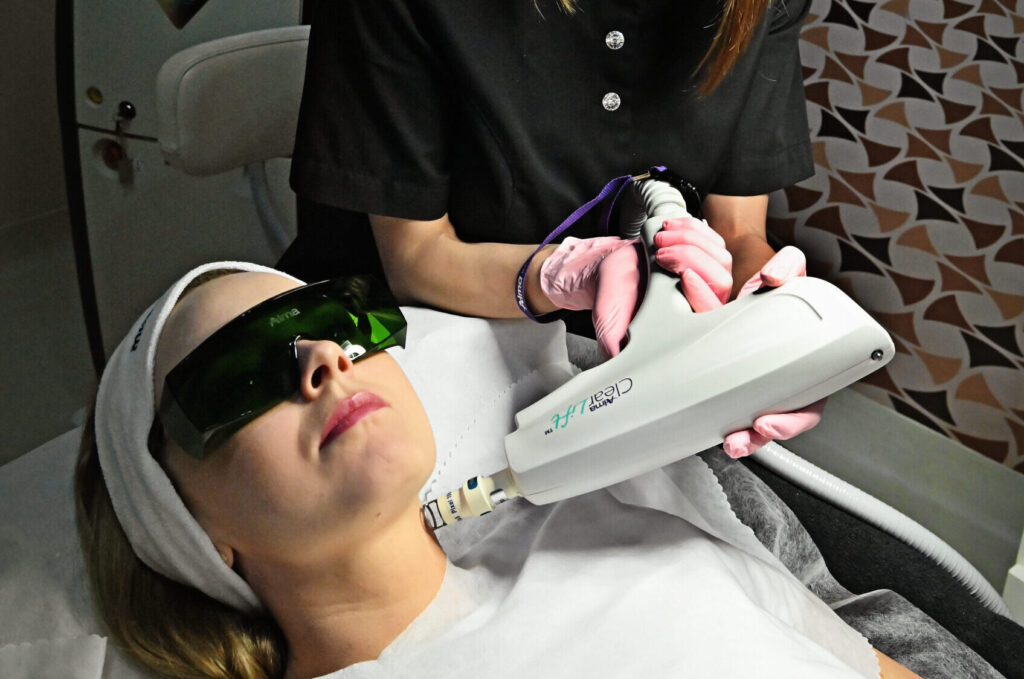 Zabieg laserowy na twarz wykonywany w DermaDent